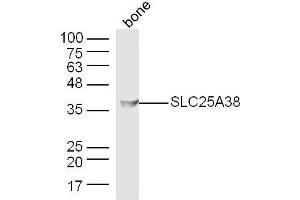 anti-Solute Carrier Family 25, Member 38 (SLC25A38) (AA 101-200) antibody