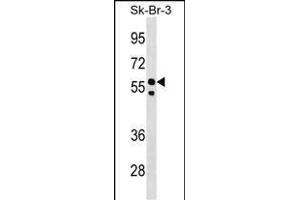 FBXO31 Antibody (Center) (ABIN1538289 and ABIN2848716) western blot analysis in SK-BR-3 cell line lysates (35 μg/lane).
