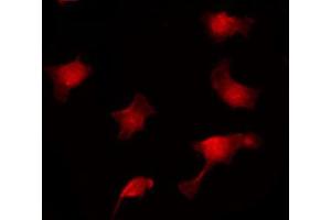 Image no. 2 for anti-Adenomatous Polyposis Coli (APC) (pSer2054) antibody (ABIN6255083)