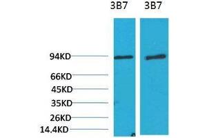 Image no. 2 for anti-Phosphoinositide 3 Kinase, p85 alpha (PI3K p85a) antibody (ABIN3181629)