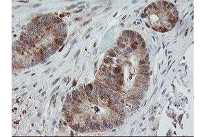 Image no. 8 for anti-Mitochondrial Ribosomal Protein S34 (MRPS34) antibody (ABIN1499564)