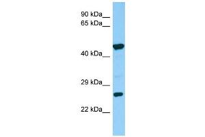 Image no. 1 for anti-Sarcoglycan, delta (35kDa Dystrophin-Associated Glycoprotein) (SGCD) (Middle Region) antibody (ABIN2781787)