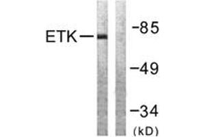 Image no. 1 for anti-BMX Non-Receptor Tyrosine Kinase (BMX) (AA 532-581) antibody (ABIN1532513)