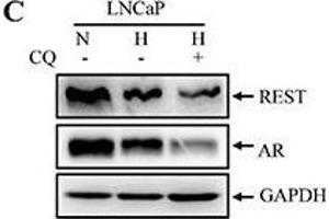 Image no. 113 for anti-Glyceraldehyde-3-Phosphate Dehydrogenase (GAPDH) (Center) antibody (ABIN2857072)