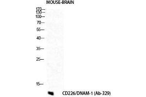 Image no. 2 for anti-CD226 (CD226) (Tyr570) antibody (ABIN3184330)