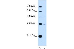 Image no. 3 for anti-Uronyl-2-Sulfotransferase (UST) (C-Term) antibody (ABIN2782688)