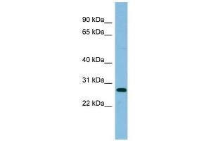 Image no. 1 for anti-Ribosomal Protein L10a (RPL10A) (Middle Region) antibody (ABIN631783)