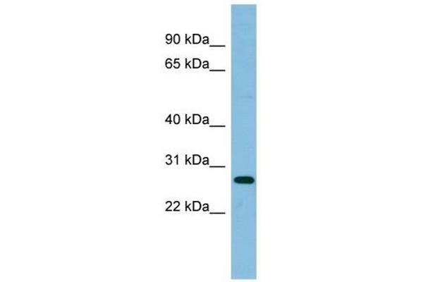 anti-Ribosomal Protein L10a (RPL10A) (Middle Region) antibody