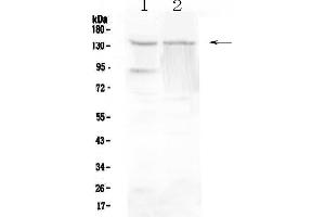 Image no. 1 for anti-Regulator of Telomere Elongation Helicase 1 (RTEL1) (AA 651-756) antibody (ABIN5693044)