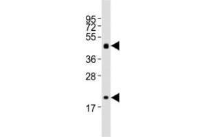 Image no. 1 for anti-Sonic Hedgehog (SHH) (N-Term) antibody (ABIN3032696)
