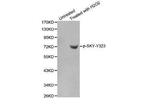Image no. 1 for anti-Spleen tyrosine Kinase (SYK) (pTyr323) antibody (ABIN3020046)