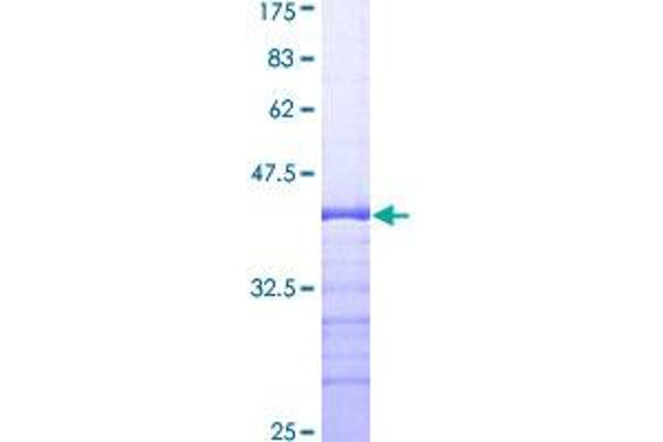 PDIA3 Protein (AA 396-505) (GST tag)