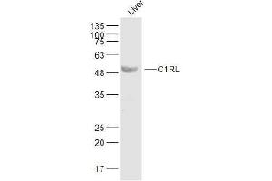 Image no. 1 for anti-Complement Component 1, R Subcomponent-Like (C1RL) (AA 101-200) antibody (ABIN2171107)