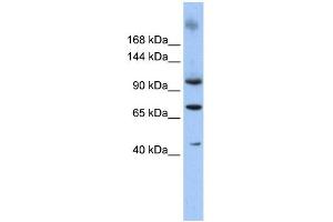 Image no. 1 for anti-Terminal Uridylyl Transferase 1, U6 SnRNA-Specific (TUT1) (N-Term) antibody (ABIN2777844)