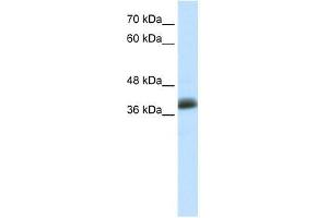 Image no. 1 for anti-SAP30 Binding Protein (SAP30BP) (C-Term) antibody (ABIN927482)