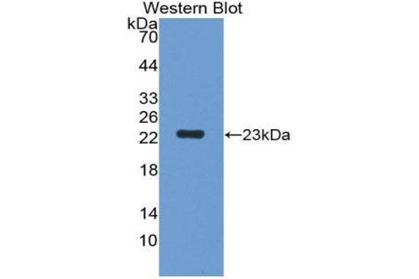 anti-Heparan Sulphate Protoglycans (HSPG) antibody (Biotin)