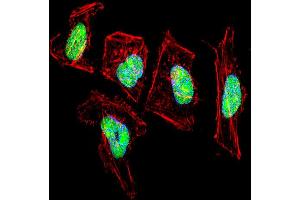Image no. 2 for anti-Nuclear Factor I/C (CCAAT-Binding Transcription Factor) (NFIC) (AA 180-208) antibody (ABIN5537206)