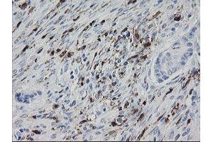 Image no. 3 for anti-Coagulation Factor XIII, A1 Polypeptide (F13A1) antibody (ABIN1498146)