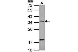Image no. 1 for anti-Thioredoxin-Related Transmembrane Protein 1 (TMX1) (C-Term) antibody (ABIN2856566)