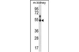 STK32B Antikörper  (C-Term)