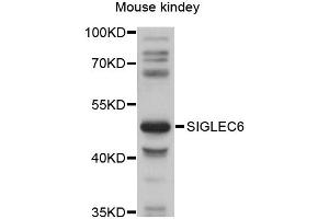 Image no. 1 for anti-Sialic Acid Binding Ig-Like Lectin 6 (SIGLEC6) antibody (ABIN6292272)