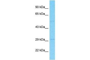 Image no. 1 for anti-Solute Carrier Family 22, Member 15 (SLC22A15) (N-Term) antibody (ABIN5517548)