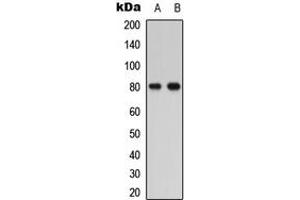 Image no. 3 for anti-Parathyroid Hormone 1 Receptor (PTH1R) (Center) antibody (ABIN2706892)