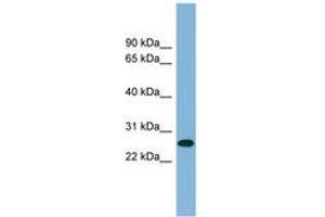Image no. 1 for anti-serine/arginine-Rich Splicing Factor 12 (SRSF12) (AA 179-228) antibody (ABIN6742016)
