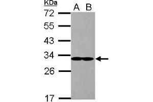 Image no. 2 for anti-Eukaryotic Translation Initiation Factor 2B, Subunit 1 Alpha, 26kDa (EIF2B1) (AA 1-305) antibody (ABIN1497966)
