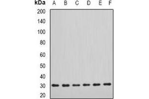 Image no. 2 for anti-Dimethylarginine Dimethylaminohydrolase 2 (DDAH2) antibody (ABIN2966558)