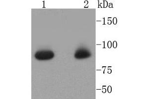 Western Blotting (WB) image for anti-Signal Transducer and Activator of Transcription 5A (STAT5A) antibody (ABIN5557532)
