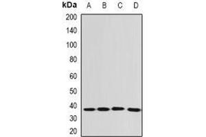Image no. 2 for anti-Eukaryotic Translation Elongation Factor 1 delta (Guanine Nucleotide Exchange Protein) (EEF1D) (full length) antibody (ABIN6043408)
