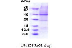 O-Sialoglycoprotein Endopeptidase (OSGEP) (AA 1-335) protein (His tag)