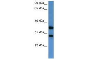 Image no. 1 for anti-serine/threonine/tyrosine Interacting-Like 1 (STYXL1) (AA 140-189) antibody (ABIN6746820)