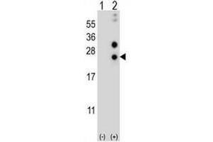 Image no. 1 for anti-Casein alpha S1 (CSN1S1) (AA 35-65), (Middle Region) antibody (ABIN950382)
