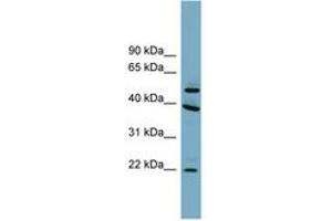 Image no. 1 for anti-Chromosome 4 Open Reading Frame 20 (C4orf20) (AA 287-336) antibody (ABIN6744145)