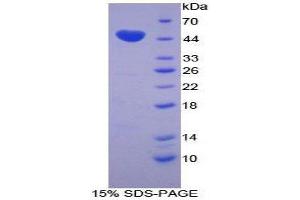 Image no. 1 for Chromogranin B (Secretogranin 1) (CHGB) (AA 309-484) protein (His tag,GST tag) (ABIN1877922)