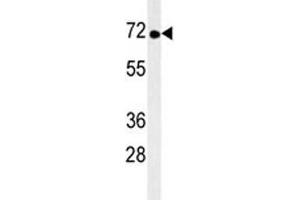 Image no. 1 for anti-Tyrosine Kinase, Non-Receptor, 1 (TNK1) antibody (ABIN3029413)