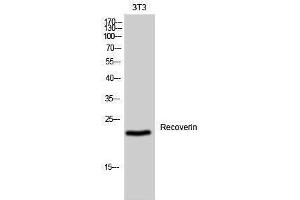Image no. 1 for anti-Recoverin (RCVRN) (Internal Region) antibody (ABIN3186719)