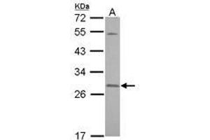 Image no. 2 for anti-Synaptosomal-Associated Protein, 23kDa (SNAP23) (AA 6-211) antibody (ABIN1501021)