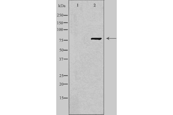 FZD6 antibody  (C-Term)