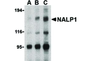 Image no. 1 for anti-NLR Family, Pyrin Domain Containing 1 (NLRP1) (C-Term) antibody (ABIN6655096)