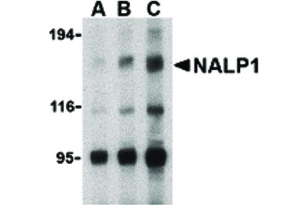 anti-NLR Family, Pyrin Domain Containing 1 (NLRP1) (C-Term) antibody