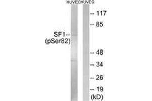 Western blot analysis of extracts from HuvEc cells treated with anisomycin 25ug/ml 30', using SF1 (Phospho-Ser82) Antibody.