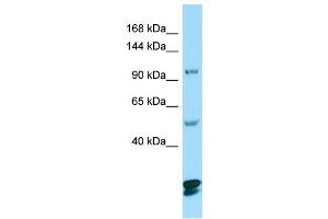 Image no. 1 for anti-Catenin (Cadherin-Associated Protein), delta 2 (Neural Plakophilin-Related Arm-Repeat Protein (CTNND2) (C-Term) antibody (ABIN2790020)