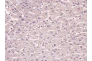 Image no. 3 for anti-Plasminogen (PLG) (AA 274-560) antibody (ABIN1078446)