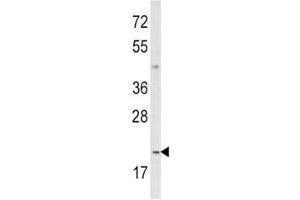 Image no. 3 for anti-Interleukin 12 (IL12) (AA 168-195) antibody (ABIN3031445)