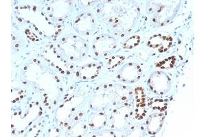 Image no. 3 for anti-Paired Box 8 (PAX8) (AA 60-261) antibody (ABIN6940924)