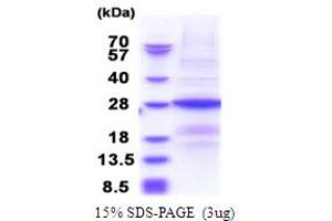 Image no. 1 for B9 Protein Domain 1 (B9D1) (AA 1-204) protein (His tag) (ABIN5853866)