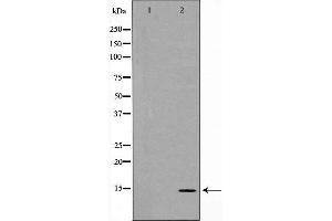 Image no. 2 for anti-Myosin Regulatory Light Chain 2, Smooth Muscle Isoform (MYL9) antibody (ABIN6266252)